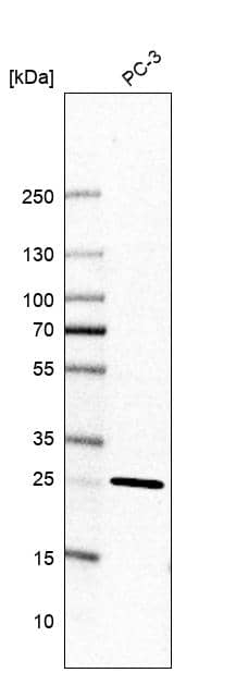 Analysis in human cell line PC-3.
