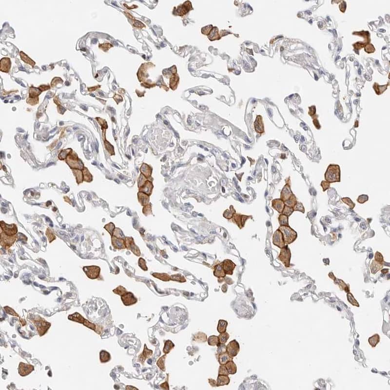 Staining of human lung shows strong membranous positivity in macrophages.