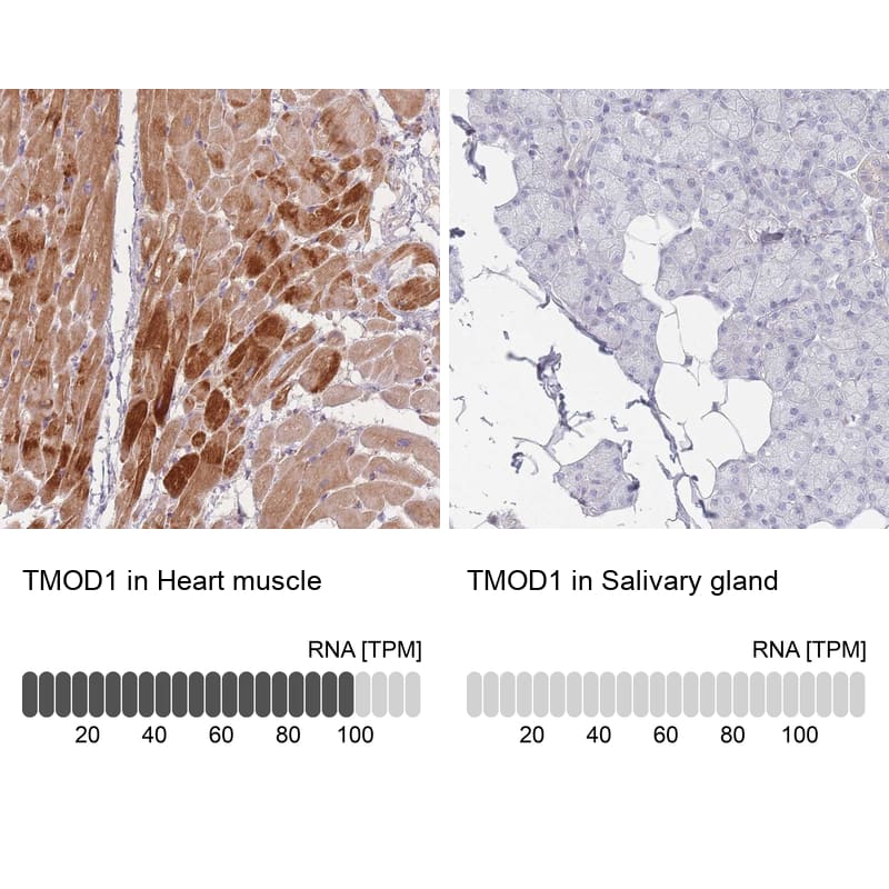 Immunohistochemistry Tropomodulin 1 Antibody - BSA Free