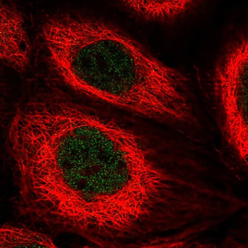 Staining of human cell line A-431 shows localization to nucleoplasm.
