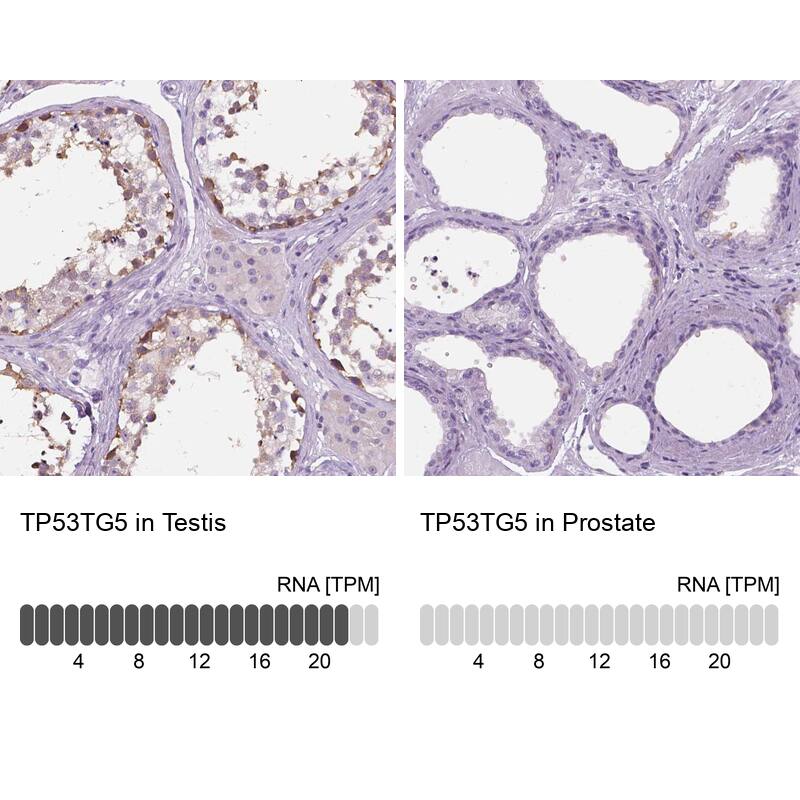 Immunohistochemistry TP53TG5 Antibody - BSA Free