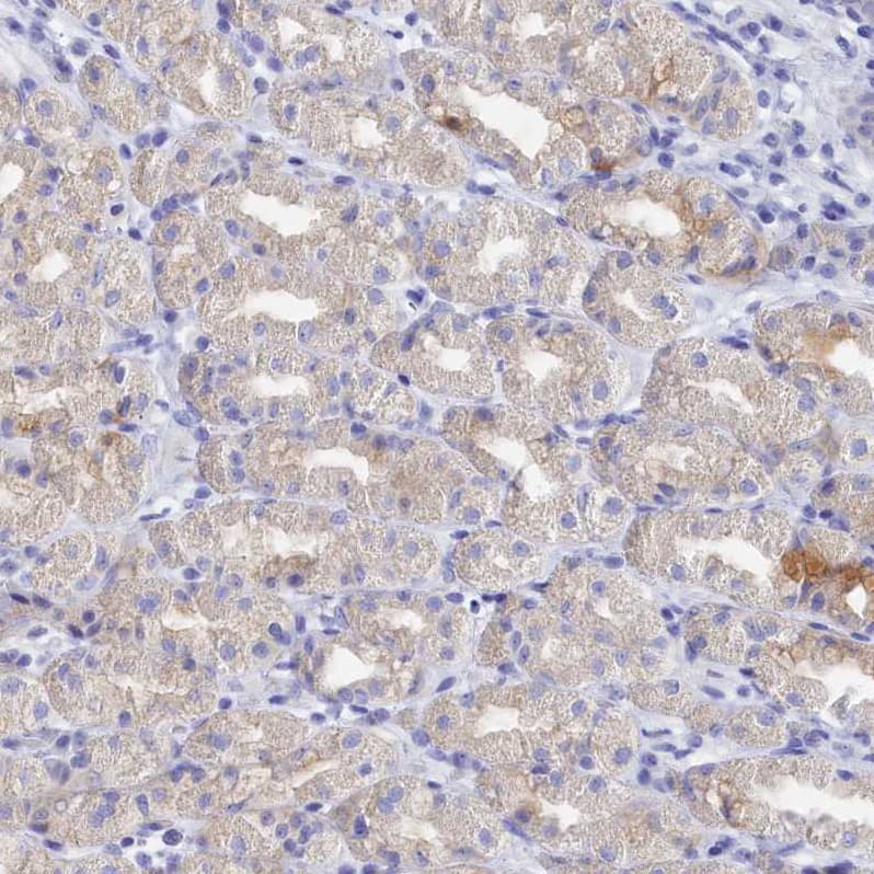 Staining of human stomach shows weak cytoplasmic positivity in parietal cells.