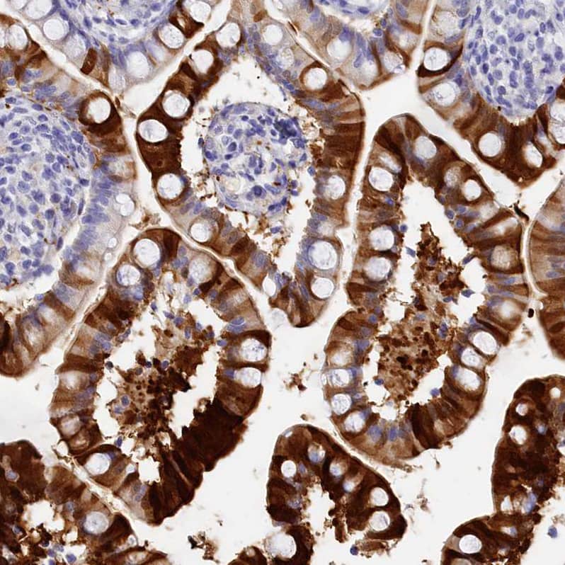 Staining of human Small intestine shows moderate cytoplasmic positivity in glandular cells.