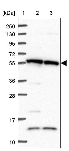 Lane 1: Marker [kDa] 250, 130, 95, 72, 55, 36, 28, 17, 10Lane 2: Human cell line RT-4Lane 3: Human cell line U-251MG sp