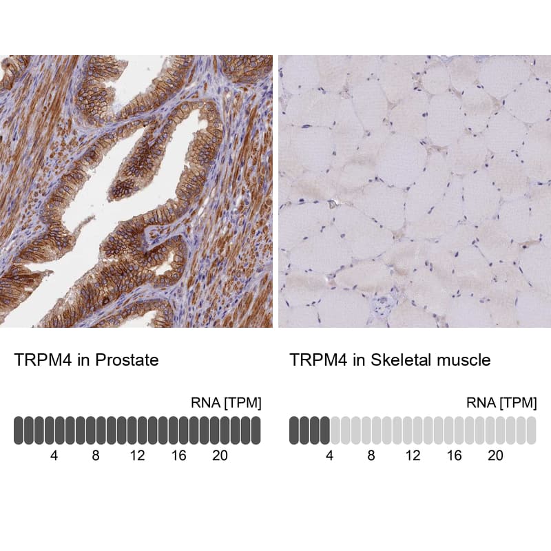 <b>Orthogonal Strategies Validation. </b>Analysis in human prostate and skeletal muscle tissues using NBP2-13487 antibody. Corresponding TRPM4 RNA-seq data are presented for the same tissues.