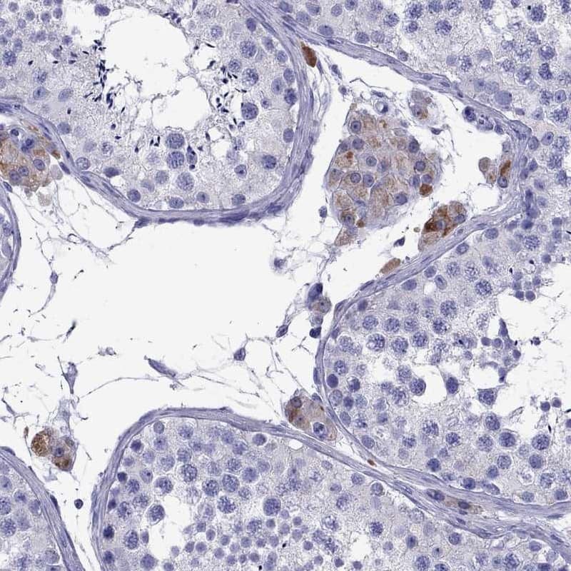 Immunohistochemistry-Paraffin TTLL13 Antibody - BSA Free