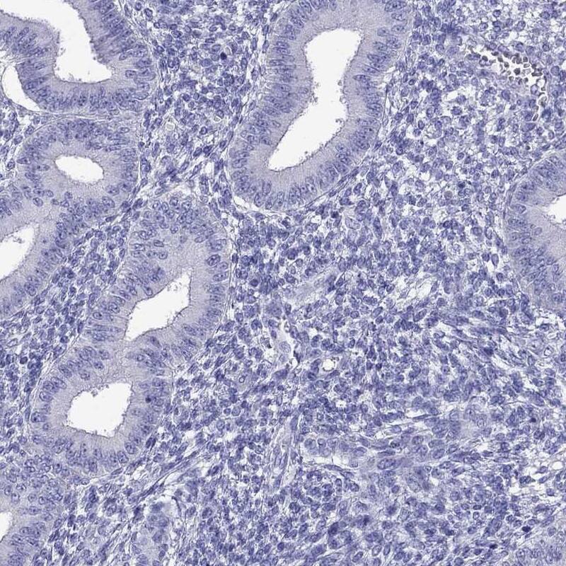 Immunohistochemistry-Paraffin TTLL13 Antibody - BSA Free
