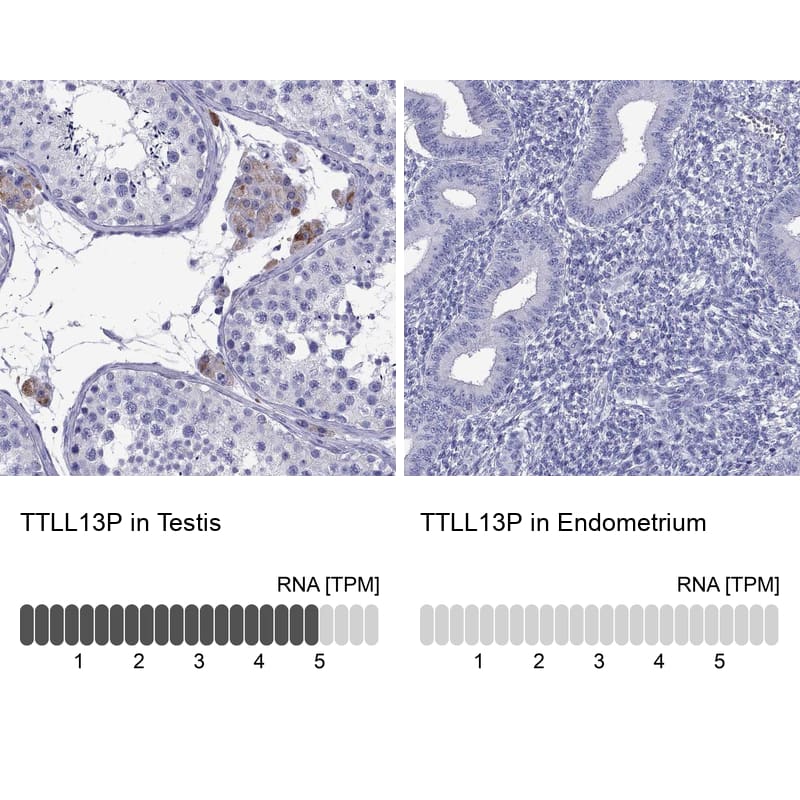 <b>Orthogonal Strategies Validation. </b>Analysis in human testis and endometrium tissues using Anti-TTLL13P antibody. Corresponding TTLL13P RNA-seq data are presented for the same tissues.