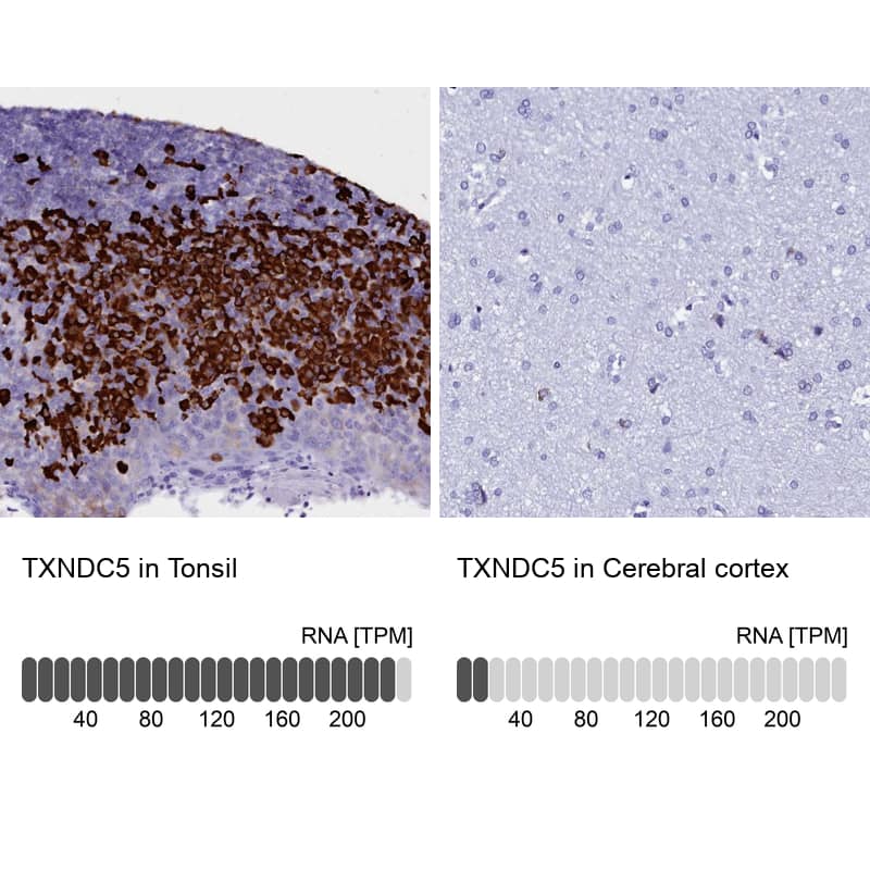 <b>Independent Antibodies Validation and Orthogonal Strategies Validation.</b>Analysis in human tonsil and cerebral cortex tissues.