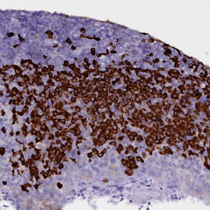 Staining of human tonsil shows high expression.