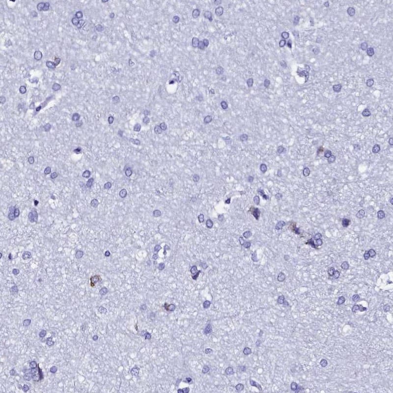 Staining of human cerebral cortex shows low expression as expected.