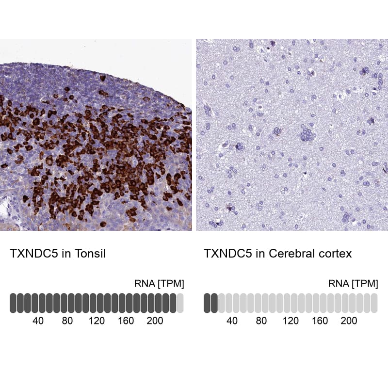 Analysis in human tonsil and cerebral cortex tissues.