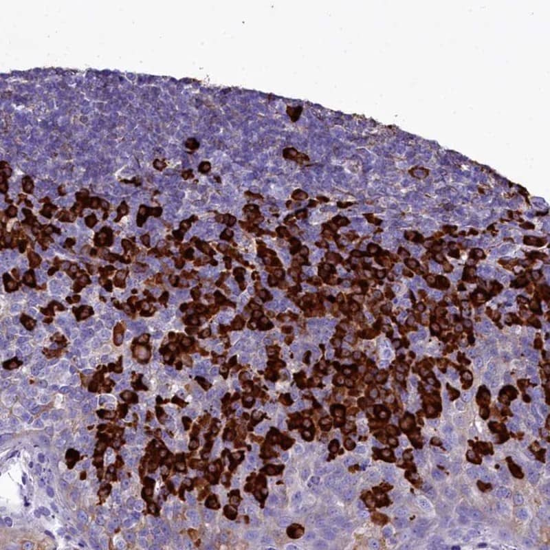 Staining of human tonsil shows high expression.