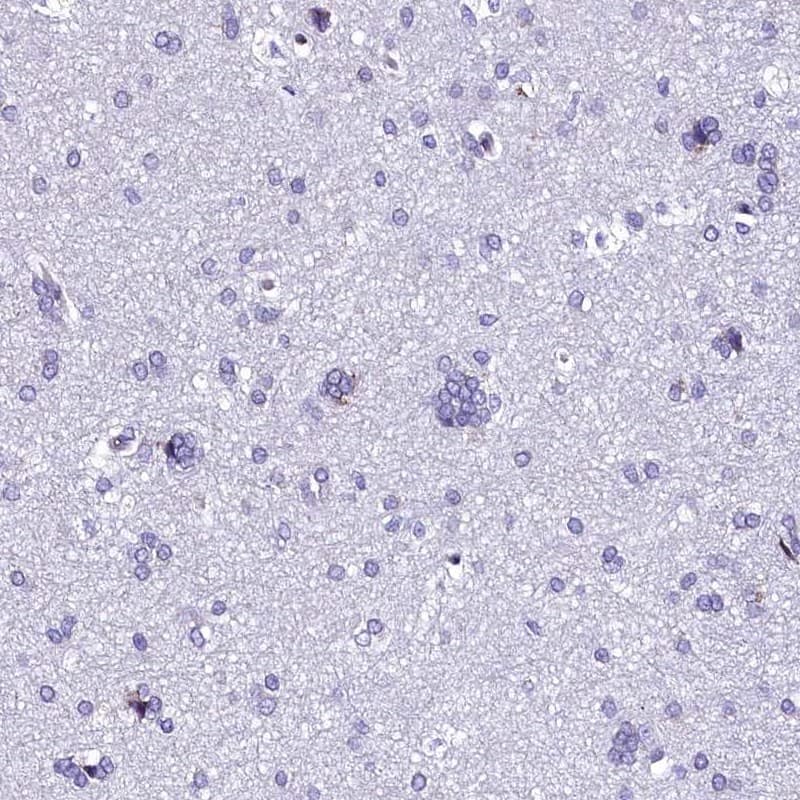 Staining of human cerebral cortex shows low expression as expected.