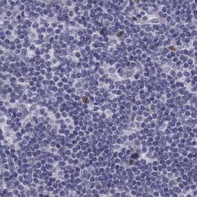 Staining of human lymph node using Anti-UHRF1 antibody NBP2-13504.