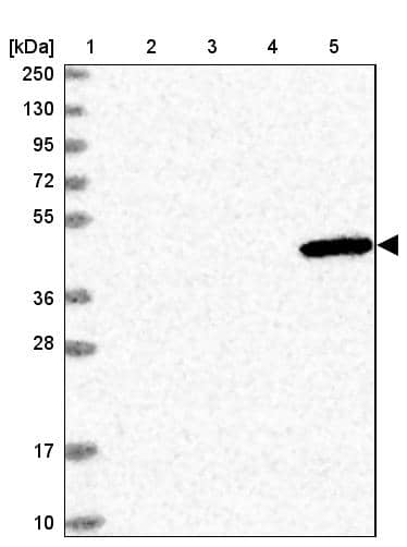 Western Blot ULK3 Antibody - BSA Free