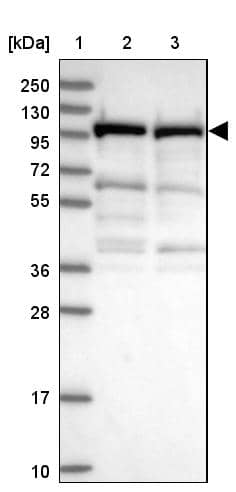 Lane 1: Marker [kDa] 250, 130, 95, 72, 55, 36, 28, 17, 10Lane 2: Human cell line RT-4Lane 3: Human cell line U-251MG sp