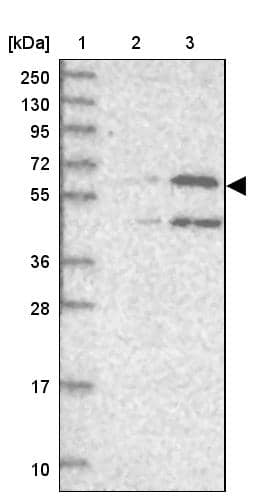 Lane 1: Marker [kDa] 250, 130, 95, 72, 55, 36, 28, 17, 10Lane 2: Human cell line RT-4Lane 3: Human cell line U-251MG sp