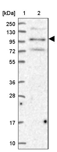 Lane 1: Marker [kDa] 250, 130, 95, 72, 55, 36, 28, 17, 10Lane 2: Human cell line RT-4