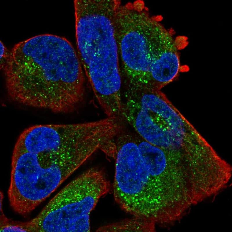 Staining of human cell line RH-30 shows localization to vesicles.