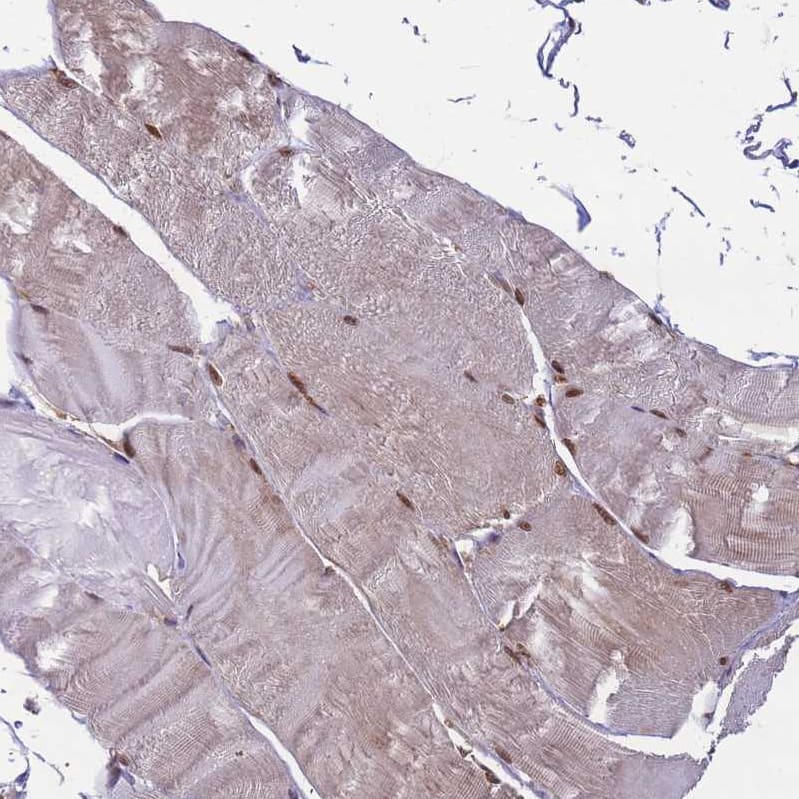 Staining of human skeletal muscle shows strong nuclear positivity in myocytes.