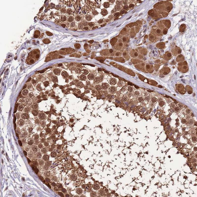 Staining of human testis shows strong nuclear and cytoplasmic positivity in cells in seminiferous ducts and Leydig cells.