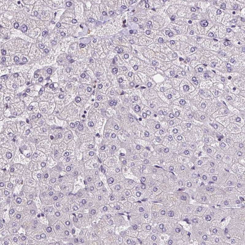 Staining of human liver shows no positivity in hepatocytes as expected.