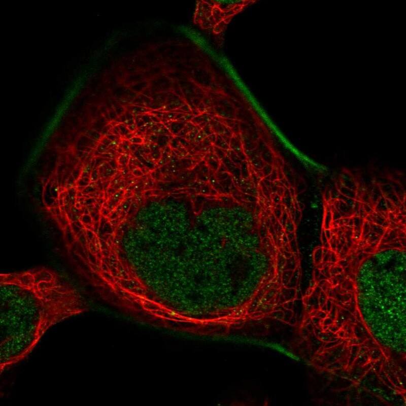 Staining of human cell line A-431 shows localization to nucleoplasm & actin filaments.