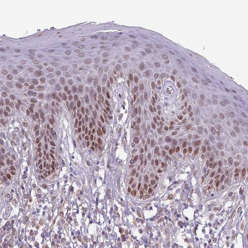 Staining of human skin shows strong nuclear positivity in squamous epithelial cells.