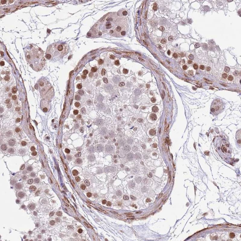 Staining of human testis shows strong nuclear positivity in spermatogonia.