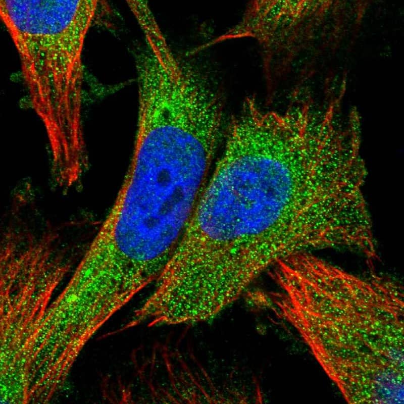 Staining of human cell line U-251 MG shows localization to cytosol.