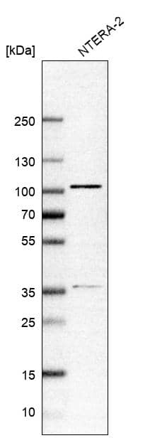 Analysis in human cell line NTERA-2.