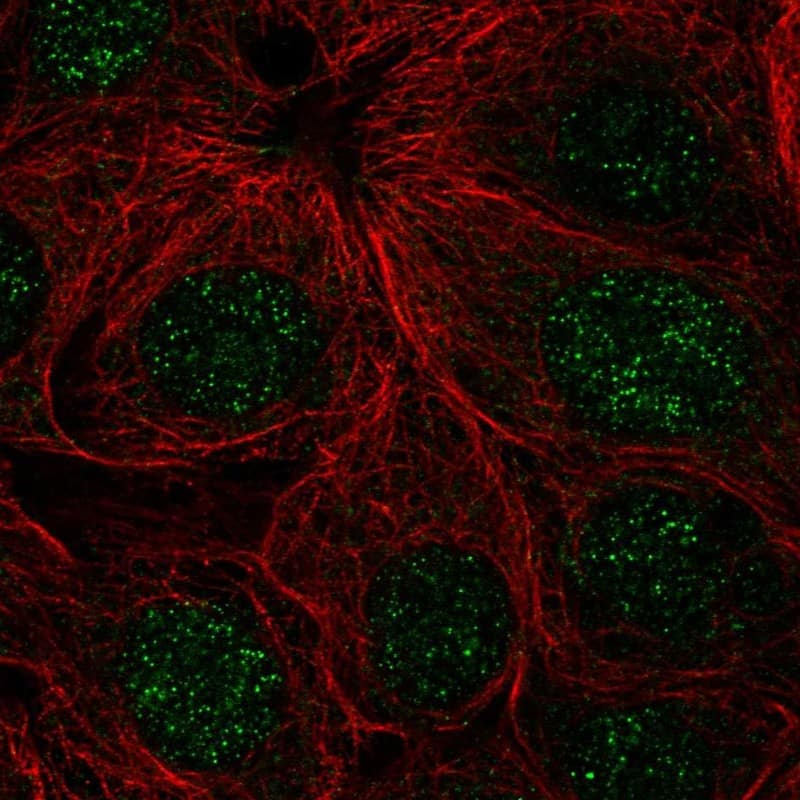 Staining of human cell line MCF7 shows localization to nucleus.
