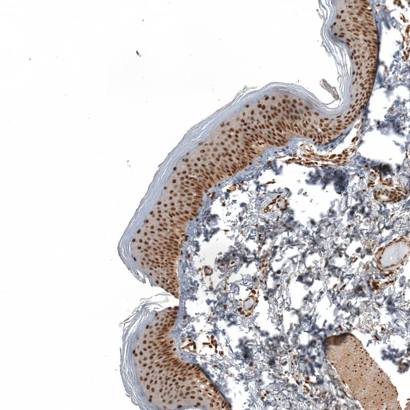 Staining of human skin shows strong nuclear positivity in squamous epithelial cells.