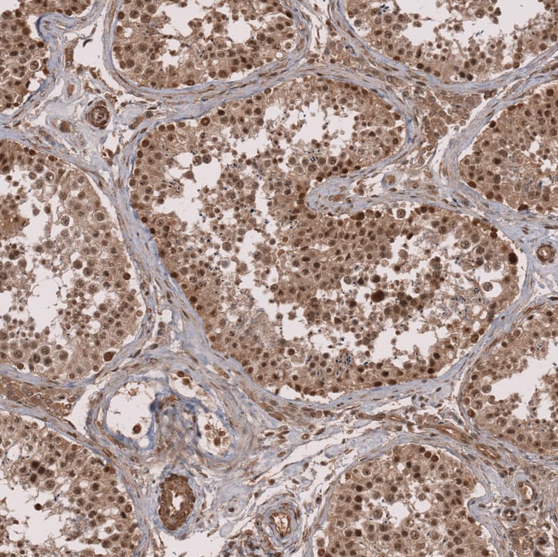 Staining of human testis shows strong nuclear positivity in cells in seminiferous ducts.