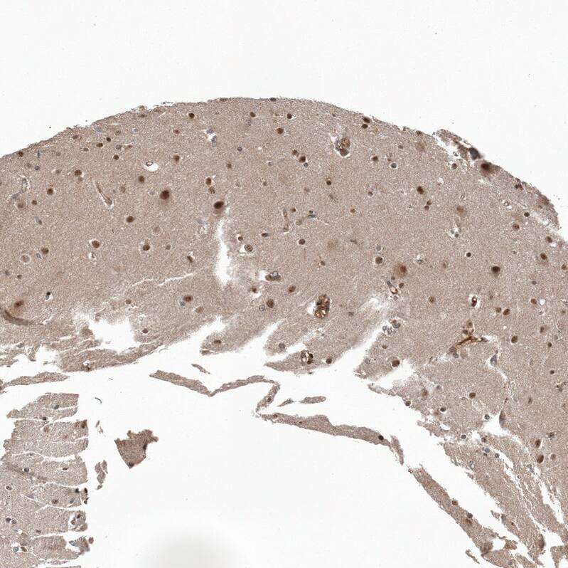 Staining of human cerebral cortex shows strong nuclear positivity in neurons.