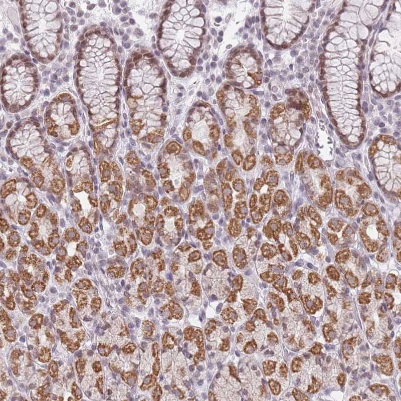 Immunohistochemistry ZNF574 Antibody - BSA Free