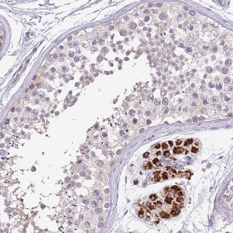 Staining of human testis shows strong cytoplasmic positivity in Leydig cells.