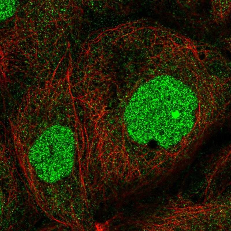 Staining of human cell line A-431 shows localization to nucleus.