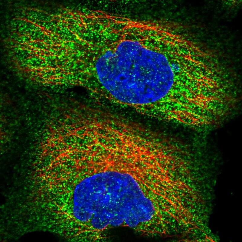 Immunocytochemistry/ Immunofluorescence ZSWIM1 Antibody - BSA Free