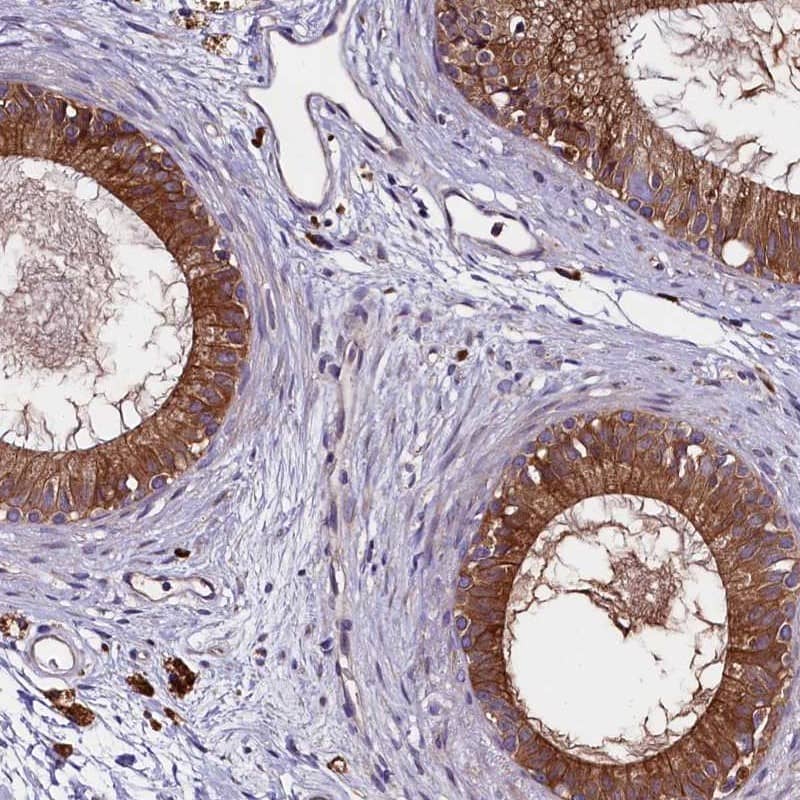 Immunohistochemistry-Paraffin ZSWIM1 Antibody - BSA Free