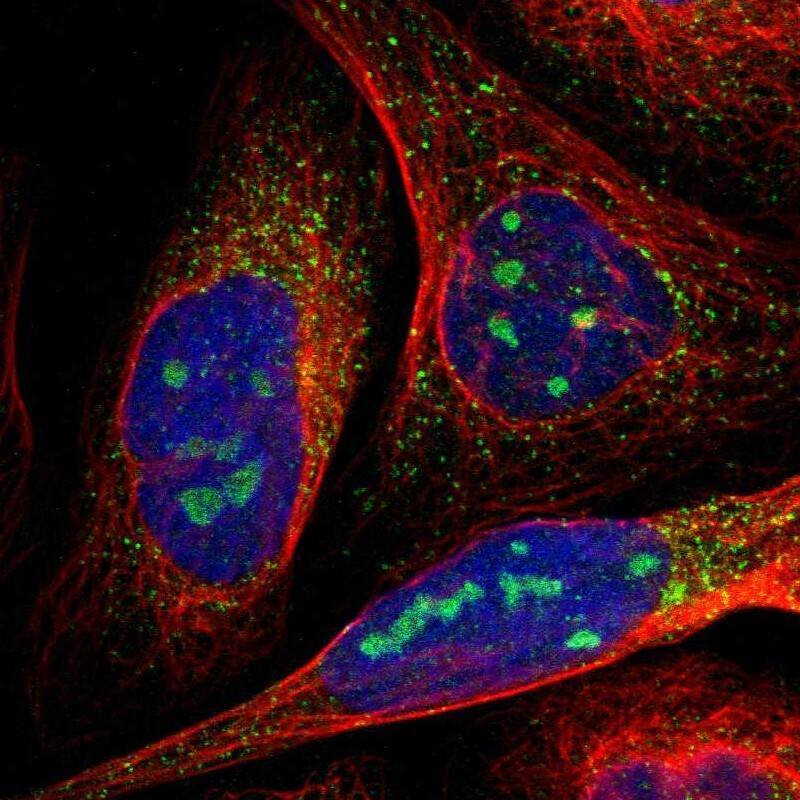 Staining of human cell line U-2 OS shows positivity in nucleoli & vesicles.