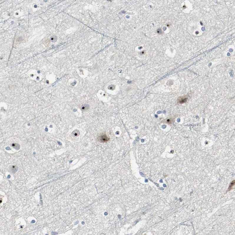 Staining of human cerebral cortex shows strong positivity in nucleoli in neurons.