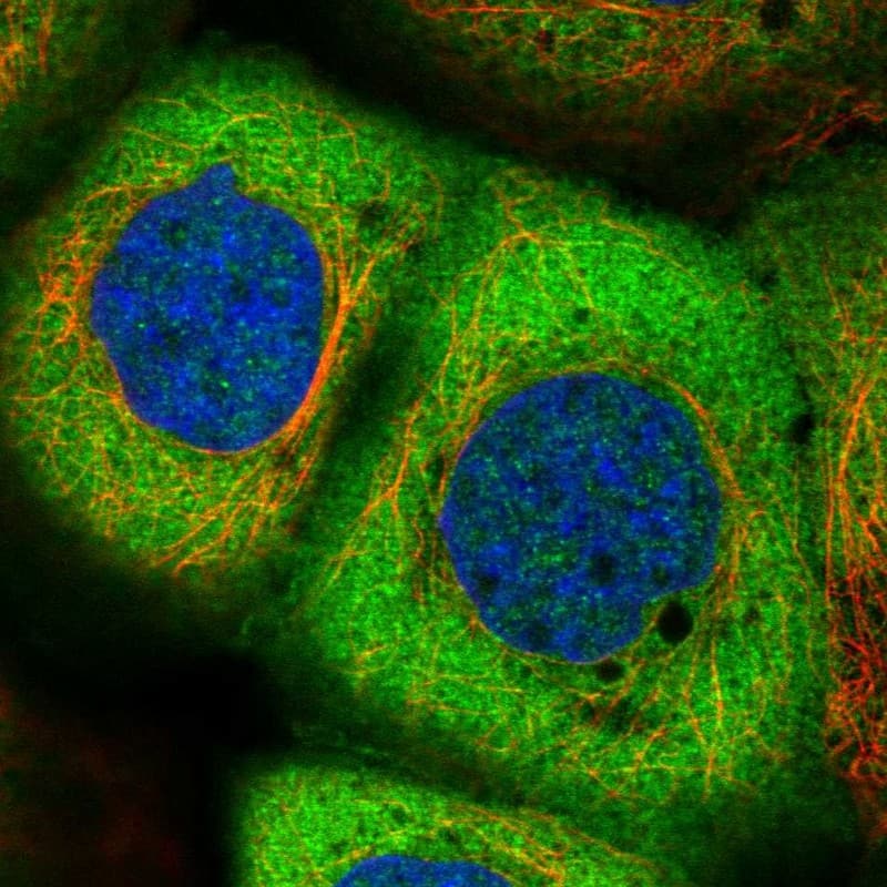 Staining of human cell line A-431 shows localization to cytosol.