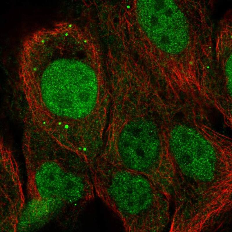 Staining of human cell line HaCaT shows localization to nucleus & vesicles.