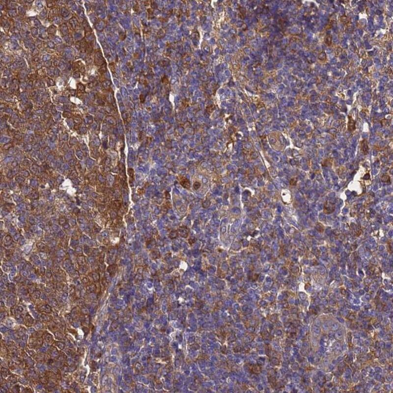 Staining of human tonsil shows moderate cytoplasmic positivity in germinal and non-germinal center cells.