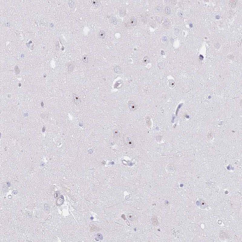 Staining of human hippocampus shows moderate nucleolar positivity in neurons.