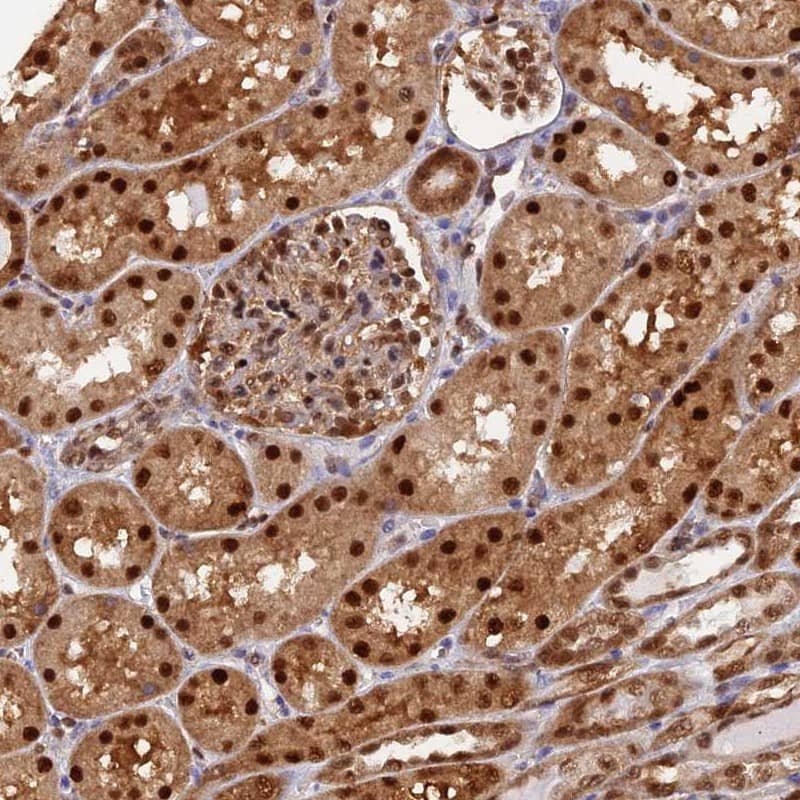 Staining of human kidney shows strong nuclear positivity in cells in tubules.