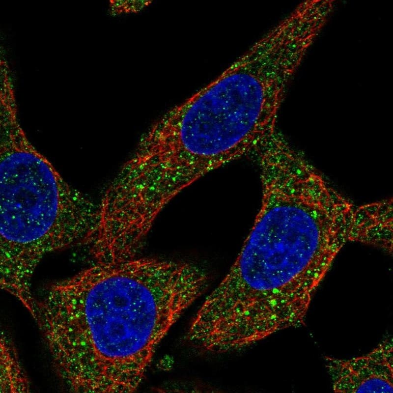 Staining of human cell line A549 shows localization to cytosol.