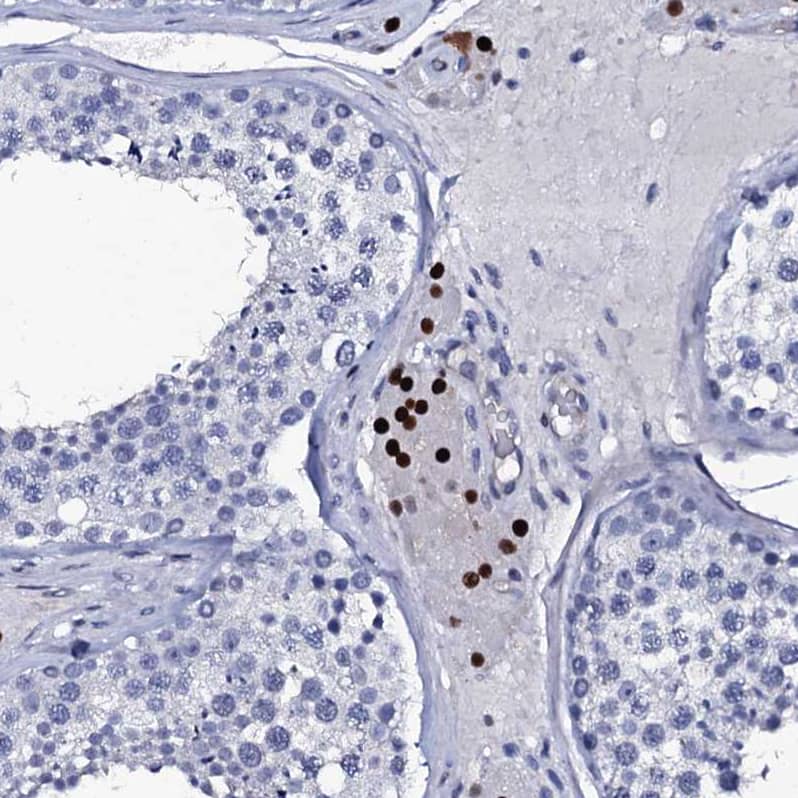 Immunohistochemistry-Paraffin Nucleoplasmin-2 Antibody - BSA Free